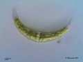 Closterium sp.